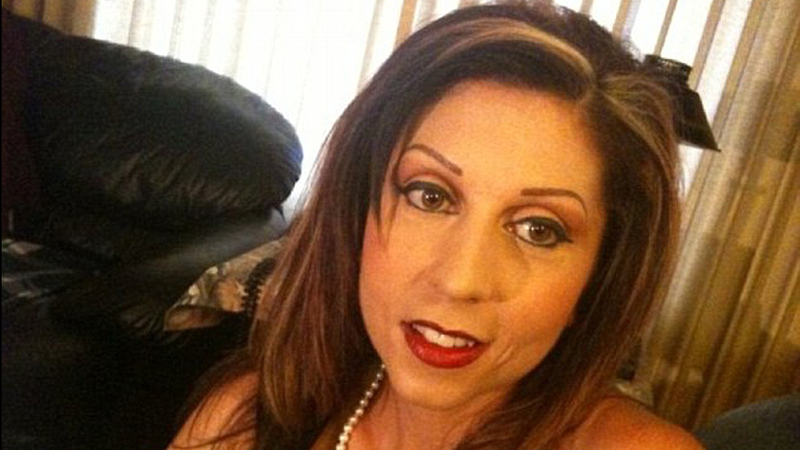 صور الممثلة رايتشل فاكر تتحول إلى هيكل عظمي بعد إصابتها بالمرض..